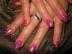 Gelov� nechty-l��enie-z�ava na febru�r
